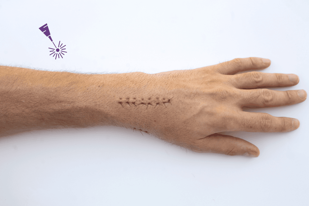 Scar Dr. Didac Barco